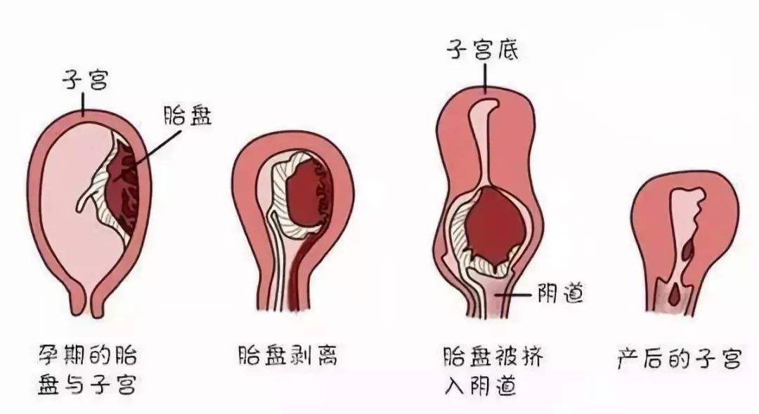 产后两个月伤口痛，原因、处理与关注