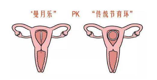 安环后半个月的月经来临，一种生理现象的探讨