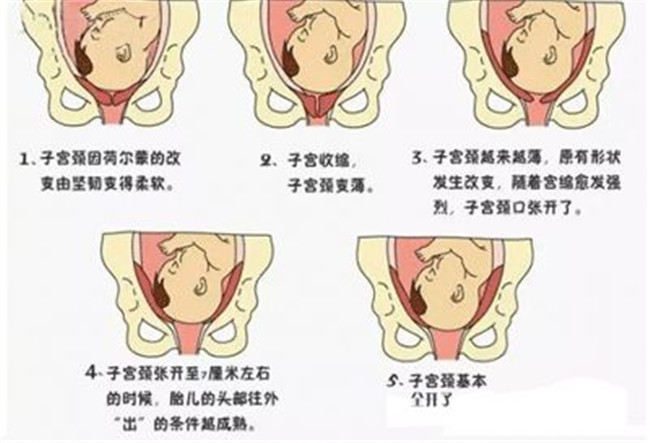 胎儿入盆的时间及其相关因素解析