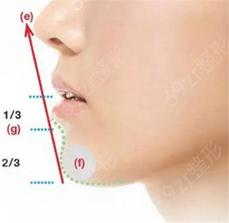 垫下巴半个月定型了吗？全面解析下巴整形后的恢复过程